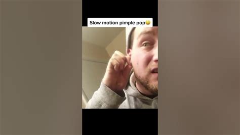 Pimple Popper gets completely splattered every once and a while doing her job, and in a new video, she just posted that is exactly. . Slow motion pimple popping